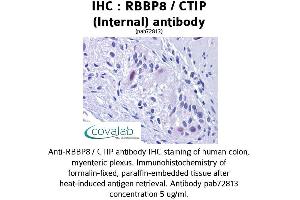 Image no. 2 for anti-Retinoblastoma Binding Protein 8 (RBBP8) (Internal Region) antibody (ABIN1738768) (Retinoblastoma Binding Protein 8 anticorps  (Internal Region))