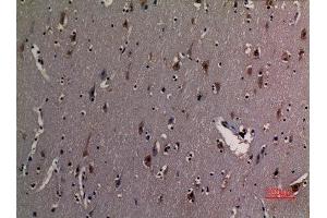 Immunohistochemistry (IHC) analysis of paraffin-embedded Human Brain, antibody was diluted at 1:100.