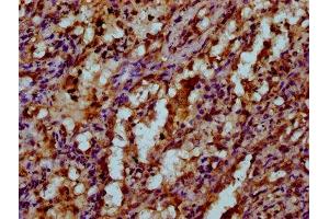 IHC image of ABIN7175529 diluted at 1:200 and staining in paraffin-embedded human lung tissue performed on a Leica BondTM system. (VKORC1 anticorps  (AA 30-74))