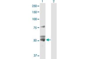 Western Blot analysis of ATP5B expression in transfected 293T cell line by ATP5B MaxPab polyclonal antibody.