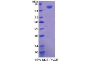 SDS-PAGE (SDS) image for 5'-Nucleotidase, Ecto (CD73) (NT5E) (AA 48-527) protein (His tag,T7 tag) (ABIN2123874)