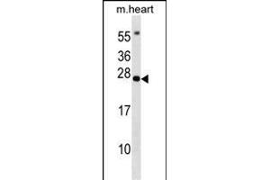 BCL7B Antibody (C-term) (ABIN1536707 and ABIN2848811) western blot analysis in mouse heart tissue lysates (35 μg/lane). (BCL7B anticorps  (C-Term))