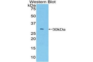 Western blot analysis of the recombinant protein. (BCL3 anticorps  (AA 127-376))