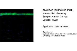 Sample Type: Human CorneaDilution: 1:200 (ALDH1A1 anticorps  (Middle Region))