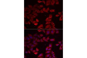 Immunofluorescence analysis of HeLa cells using SEPHS1 antibody (ABIN5973853). (SEPHS1 anticorps)