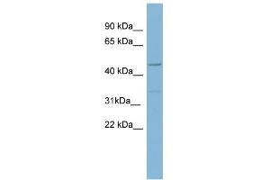 WB Suggested Anti-MATN1 Antibody Titration:  0.
