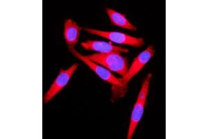 IF analysis of KLC1 using anti-KLC1 antibody (ABIN7599469). (KLC1 anticorps  (AA 1-537))
