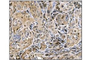 IHC analysis of Caspase-9/CASP9 using anti-Caspase-9/CASP9 antibody (ABIN7600340). (Caspase 9 anticorps  (AA 18-416))