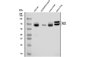 Western blot analysis of KLC1 using anti-KLC1 antibody (ABIN7599469). (KLC1 anticorps  (AA 1-537))