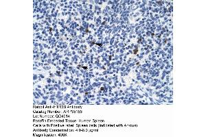 Rabbit Anti-HTR3B Antibody  Paraffin Embedded Tissue: Human Spleen Cellular Data: Spleen cells Antibody Concentration: 4.