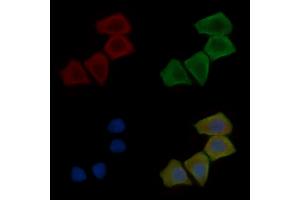 ABIN7096961 and ABIN7101028 staining Hela cells(30 min of UV treatment) by IF/ICC. (NIPA2 anticorps)