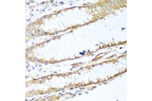 Immunohistochemistry of paraffin-embedded human stomach using MYH9 antibody.