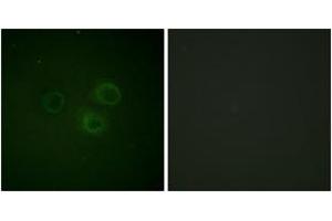 Immunofluorescence analysis of A549 cells, using CD226/DNAM-1 (Phospho-Ser329) Antibody. (CD226 anticorps  (pSer329))