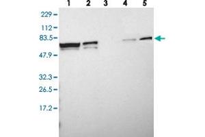 Western blot analysis of Lane 1: RT-4, Lane 2: U-251 MG, Lane 3: Human Plasma, Lane 4: Liver, Lane 5: Tonsil with MYEF2 polyclonal antibody  at 1:250-1:500 dilution.