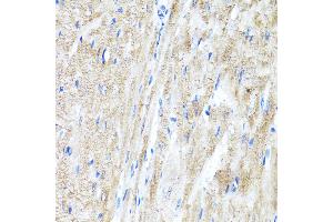 Immunohistochemistry of paraffin-embedded Rat heart using IFN antibody (ABIN3015562, ABIN3015563, ABIN3015564 and ABIN6218872) at dilution of 1:100 (40x lens). (IFNAR2 anticorps  (AA 27-243))