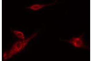 ABIN6278579 staining Hela cells by IF/ICC. (HK3 anticorps  (Internal Region))