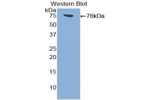 Western Blotting (WB) image for anti-Intercellular Adhesion Molecule 1 (ICAM1) (AA 26-480) antibody (ABIN1859239) (ICAM1 anticorps  (AA 26-480))