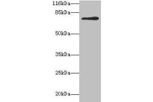Western blot All lanes: MTHFR antibody at 2 μg/mL + 293T whole cell lysate Secondary Goat polyclonal to rabbit IgG at 1/10000 dilution Predicted band size: 75, 79 kDa Observed band size: 75 kDa (MTHFR anticorps  (AA 1-656))