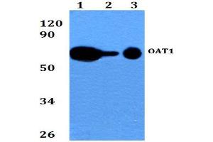 Western blot  analysis of SLC22A6 / OAT1 Antibody at 1/500 dilution. (SLC22A6 anticorps)
