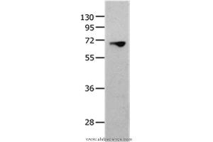 Western blot analysis of 823 cell, using MMP25 Polyclonal Antibody at dilution of 1:1300 (MMP25 anticorps)