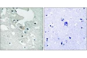 Immunohistochemistry analysis of paraffin-embedded human brain, using BLNK (Phospho-Tyr84) Antibody. (B-Cell Linker anticorps  (pTyr84))
