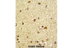 Immunohistochemistry (IHC) image for anti-Core-Binding Factor, beta Subunit (CBFB) antibody (ABIN3002868) (CBFB anticorps)