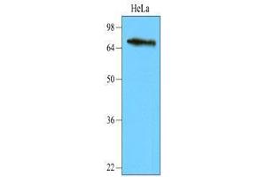 Cell lysates of HeLa (40 ug) were resolved by SDS-PAGE, transferred to nitrocellulose membrane and probed with anti-human NSD3 (1:2,000). (WHSC1L1 anticorps  (AA 383-660))
