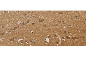 Immunohistochemistry of paraffin-embedded Human brain tissue using CSNK2B Polyclonal Antibody at dilution of 1:30(x200)