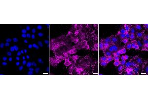 Immunocytochemical staining of HepG2 cells with Histone deacetylase 6 antibody (ABIN7798935), 1:1,000). (Recombinant HDAC6 anticorps)