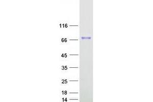 Validation with Western Blot