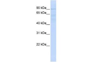 WB Suggested Anti-RNF10 Antibody Titration:  0. (RNF10 anticorps  (N-Term))