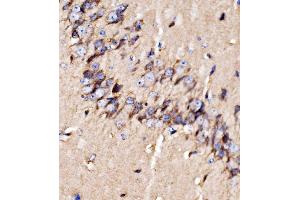 IHC analysis of GPR54/KISS1R using anti-GPR54/KISS1R antibody (ABIN7602153). (KISS1R anticorps  (AA 60-373))
