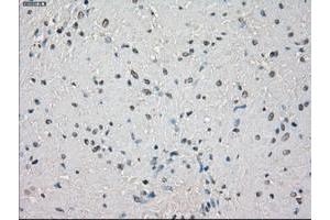 Image no. 6 for anti-Fc Fragment of IgG, Low Affinity IIa, Receptor (CD32) (FCGR2A) antibody (ABIN1497264)