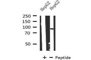 Western blot analysis on HepG2 cells lysate using CPT1A antibody