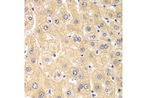 Immunohistochemistry of paraffin-embedded human liver injury using IMPA1 antibody at dilution of 1:100 (x40 lens).