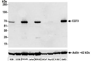 Western Blotting (WB) image for anti-5'-Nucleotidase, Ecto (CD73) (NT5E) (AA 27-552) antibody (ABIN7449540)