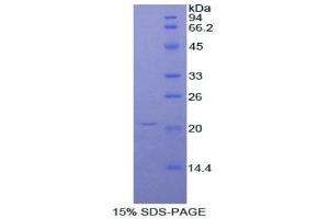 SDS-PAGE of Protein Standard from the Kit (Highly purified E. (ORM1 Kit ELISA)