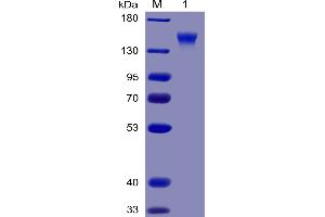 Human CD96 Protein, mFc-His Tag on SDS-PAGE under reducing condition.