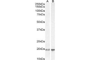 ABIN184805 (2µg/ml) staining of HEK293 (A) and HeLa (B) cell lysate (35µg protein in RIPA buffer). (UBE2C anticorps  (C-Term))