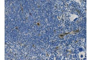 IHC analysis of MCAM using anti-MCAM antibody (ABIN7601026). (MCAM anticorps  (AA 27-621))