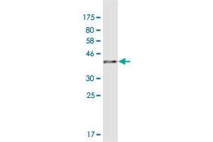 Western Blot detection against Immunogen (41 KDa) . (AKR1CL1 anticorps  (AA 1-129))