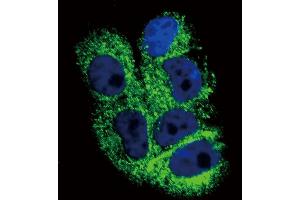 Confocal immunofluorescent analysis of COL6A1 Antibody (C-term) (ABIN390513 and ABIN2840867) with  cell followed by Alexa Fluor 488-conjugated goat anti-rabbit lgG (green).