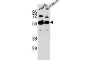 Western Blotting (WB) image for anti-RAP1, GTP-GDP Dissociation Stimulator 1 (RAP1GDS1) antibody (ABIN2996449) (RAP1GDS1 anticorps)