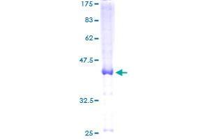 Image no. 1 for Leucine Rich Repeat Containing 8 Family, Member D (LRRC8D) (AA 1-143) protein (GST tag) (ABIN1309799)