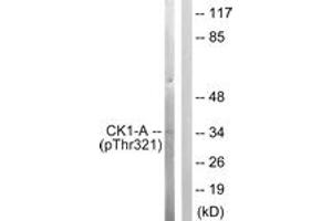 Western blot analysis of extracts from HuvEc cells, using Casein Kinase I alpha (Phospho-Tyr321) Antibody. (CSNK1A1 anticorps  (pThr321))