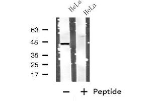 Western blot analysis of extracts from HeLa cells, using CTSD antibody. (Cathepsin D anticorps  (C-Term))