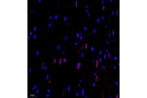 Immunofluorescence of paraffin embedded mouse heart using CITED4 (ABIN7073356) at dilution of 1:2200 (400x lens) (CITED4 anticorps)