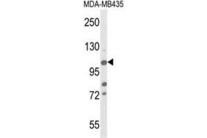 Western Blotting (WB) image for anti-Lysine (K)-Specific Demethylase 4B (KDM4B) antibody (ABIN3004253) (KDM4B anticorps)