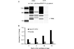 Transcription factor activity assay of TFEB from nuclear extracts of HepG2 cells or HepG2 cells treated with HBSS medium for 4 hr. (c-MYC Kit ELISA)