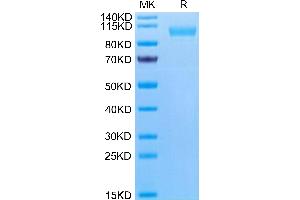 Human CD9P1 on Tris-Bis PAGE under reduced condition.
